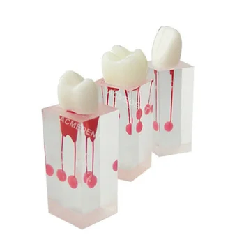  3шт Стоматологичен Файл Влак RCT на коренови канали Изследване на Зъбите на Практика Модел Эндодонтический Басейн 3 вида